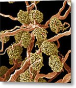 Kidney Glomeruli, Sem #8 Metal Print