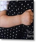 Baby S Arm On Mother S Back Metal Print