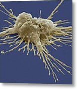 Pluripotent Stem Cell, Sem Metal Print