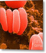 Red Blood Cells, Rouleaux Formation, Sem Metal Print
