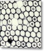 Reovirus Metal Print