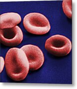 Sem Of Red Blood Cells Metal Print