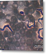 Trypanosoma Brucei Gambiense, Lm Metal Print