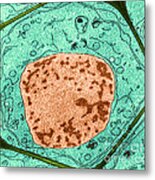 Typical Plant Cell Metal Print