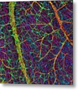 Retina Blood Vessels And Nerve Cells Metal Print