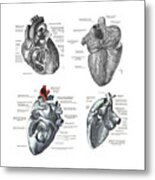 4 Views Of The Human Heart  #1 Metal Print