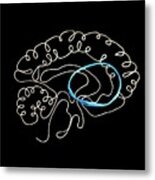 Brain's Cbgtc Loop #1 Metal Print