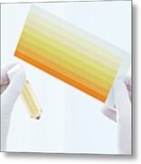 Urine Sample In Container And Chart #1 Metal Print