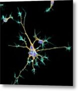 Neurons From Stem Cells #2 Metal Print