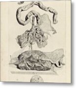 Anatomical Study Of The Umbilical Cord And The Placenta, Pieter Van Gunst, After Gerard De Lairesse, Metal Print