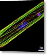 Artificial Heart Muscle Cell For Cardiotoxicity Tests Metal Print