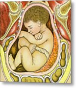 Baby Inside Womb Metal Print