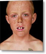 Boy 8-9 With Freckles And Mohawk Metal Print