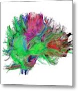 Brain Fibres Side View Right Metal Print