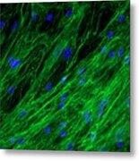 Dermal Fibroblast Cells Metal Print
