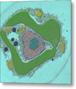 Freshwater Algae, Dinobryon Sp., Tem Metal Print
