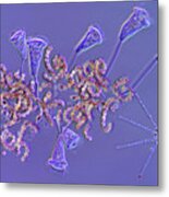 Pseudovorticella And Cyanobacteria Metal Print