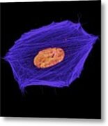 Single Neuroblastoma Cell Metal Print