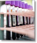 Laboratory Result With Blood Tubes Metal Print