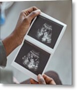 Ultrasound Image In Woman's Hand Metal Print