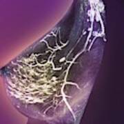 after breast pain biopsy Nerve