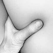 Close Up Of Hand Squeezing Skin #1 Poster