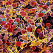 Coloured Sem Of Adipose Tissue Showing Fat Cells Poster
