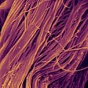 Heart Muscle Collagen Fibres #1 Poster