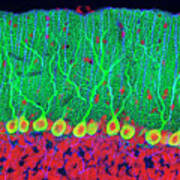 Purkinje Nerve Cells In The Cerebellum Poster
