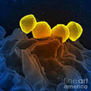 Streptococcus Pyogenes Bacteria Sem Poster