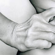 Close Up Of Hand Squeezing Skin #3 Poster