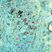 Group C Rna Tumor Virus Particles, Tem #3 Poster