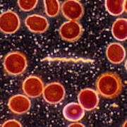 Borrelia Burgdorferi, Lm #4 Poster