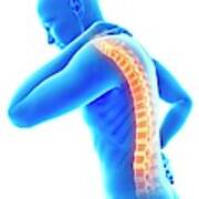 Human Back Pain #62 Poster