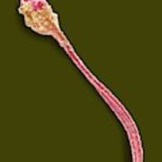 Abnormal Human Sperm Cell Poster