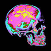Computer Graphics Coloured Human Skull Poster