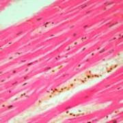 Human Cardiac Muscle Poster