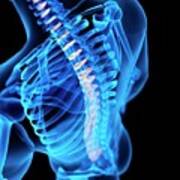 Human Intervertebral Discs Poster