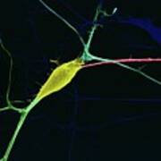 Neuron Growing In Culture Poster