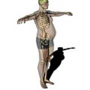 Obese Man, Anatomical Artwork Poster