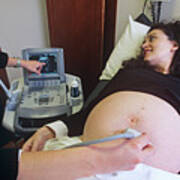 Pregnancy Ultrasound Scan Poster