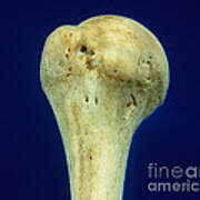 Right Humerus, Anterior View Poster