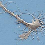 Stem Cell-derived Neuron Growth Cone Poster