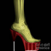 Stiletto High-heeled Shoe Poster