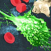 Cancer Cell Death, Sem 1 Of 6 #1 Poster