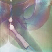 Urethritis, X-ray #1 Poster