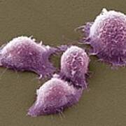 Cervical Cancer Cells, Sem #4 Poster