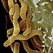 Helicobacter Pylori Bacteria, Sem #9 Poster