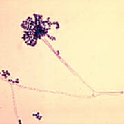 Phialoconidia Of Aspergillus Fumigatus Poster