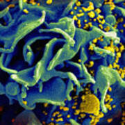 Hiv-infected T Cell, Sem Poster